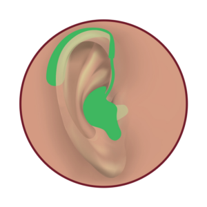 Brampton Hearing Aids Behind The Ear BTE Hearing Aids
