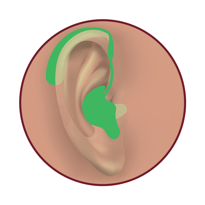 Brampton Hearing Aids Behind The Ear BTE Hearing Aids