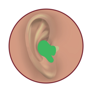 Brampton Hearing Aids In The Ear ITE Hearing Aids